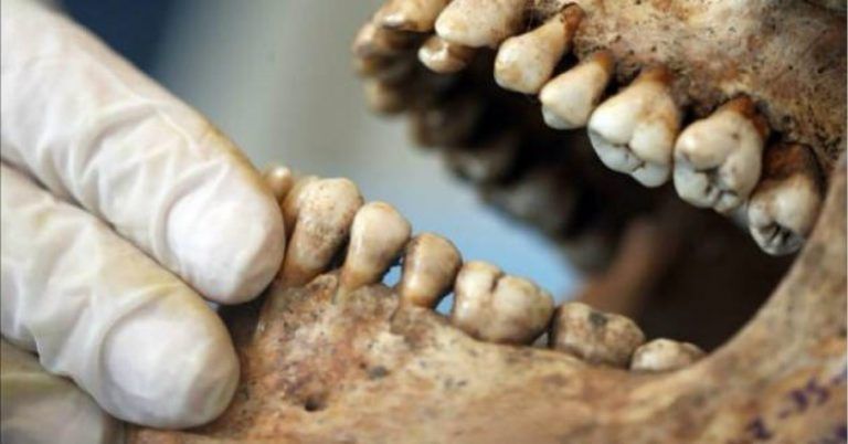 dentadura-como-prueba-forense-clinica-dental-gran-via-alicante-clinica-dental-alicante-dentista-alicante-4