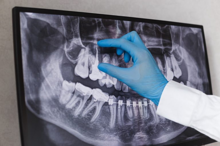 clinica-dental-gran-via-alicante-clinica-dental-alicante-materiales-biocompatibles-para-implantes