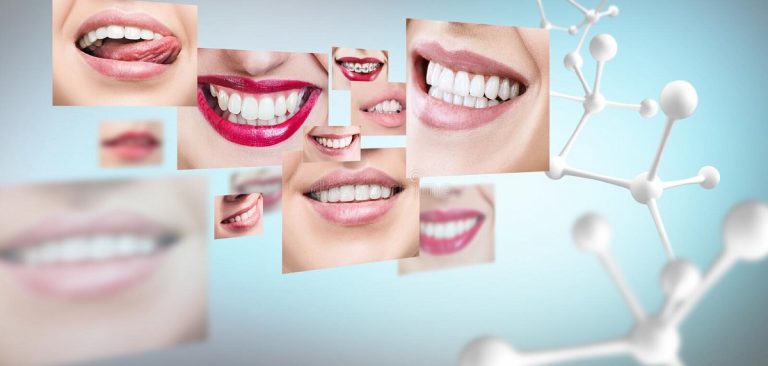clinica-dental-gran-via-alicante-genetica-dental-clinica-dental-alicante-1