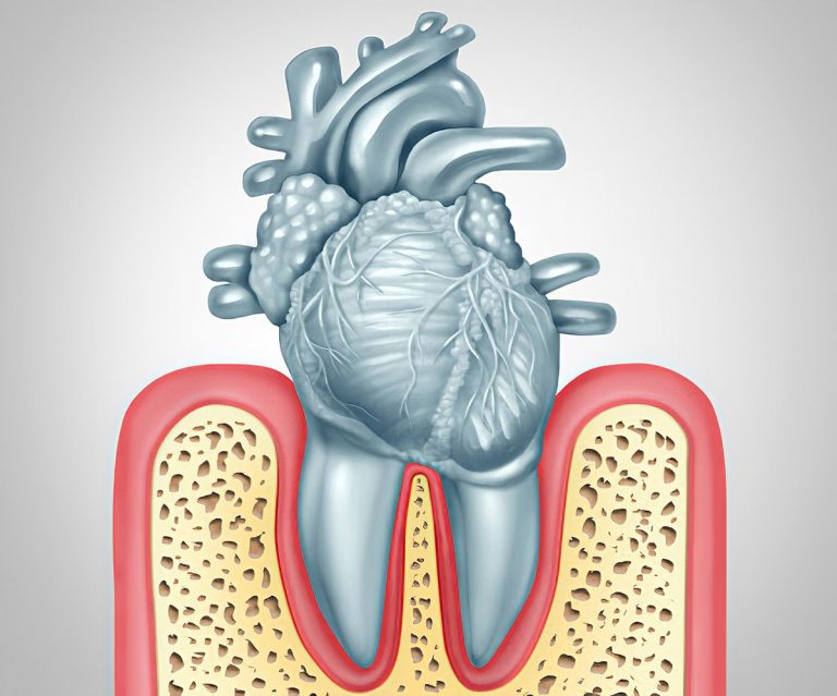 clinica-dental-gran-via-alicante-enfermedades-cardiovasculares