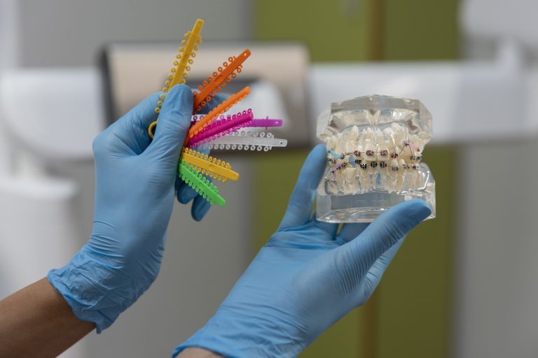 el-bisfenol-en-odontología-biológica-clinica-dental-gran-via-alicante-dentista-alicante (3)