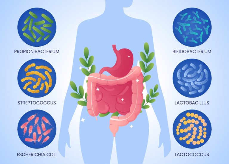 disbiosis-intestinal-clinica-dental-gran-via-alicante-dentista-alicante-clinica-dental-alicante (1)