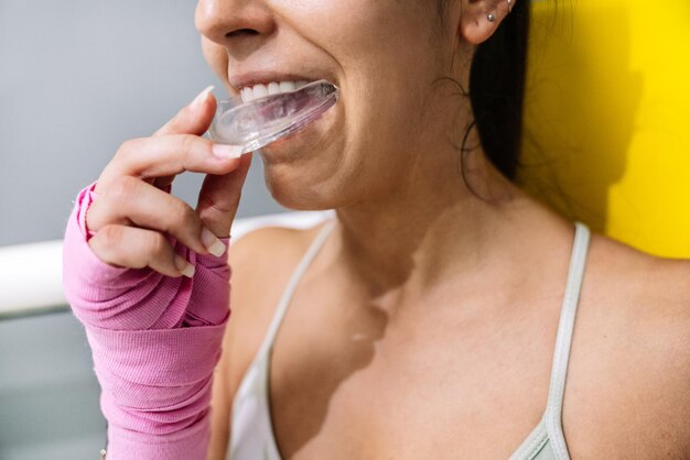protector-bucal-Alicante-clinica-dental-gran-via-alicante-dentista-alicante-clinica-denta (1)