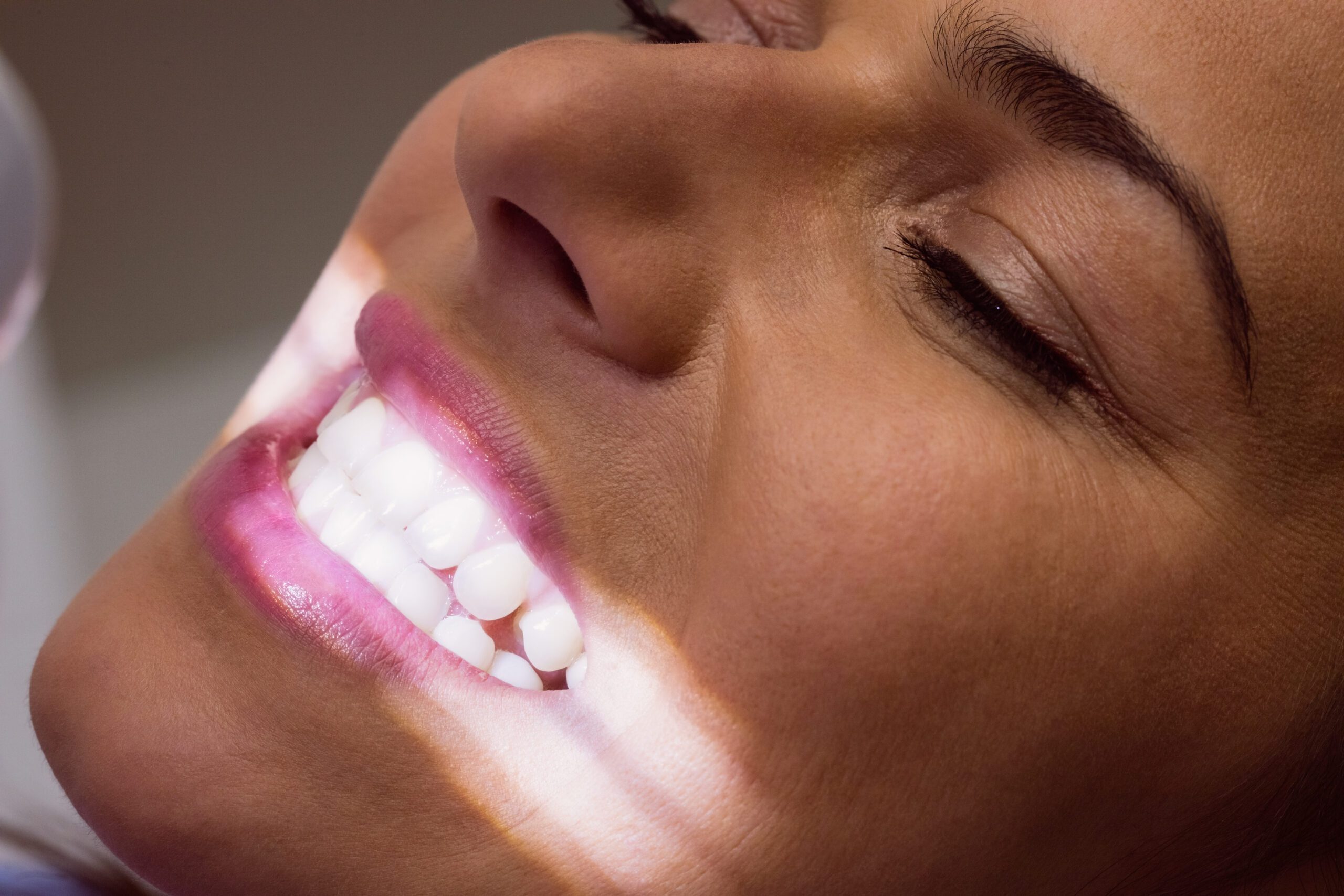 Láser-de-Diodo-EPIC-clinica-dental-gran-via-alicante-dentista-alicante-clinica-dental-alicante