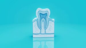 Endodoncias dientes desvitalizados