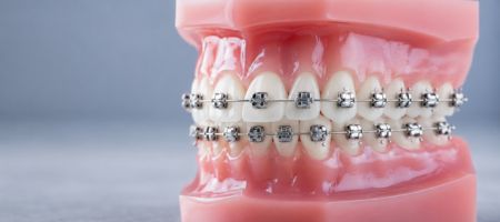 BRAKETS ALICANTE
