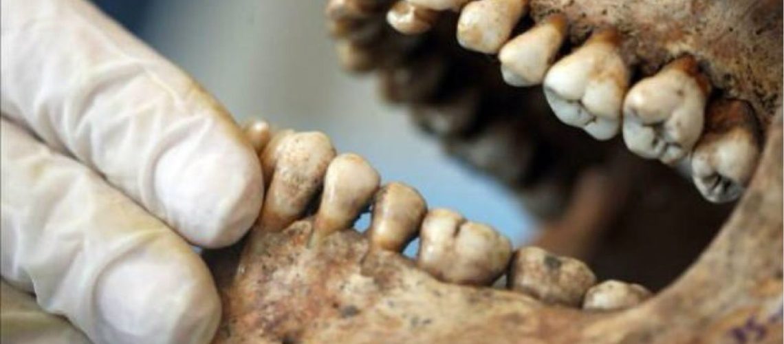 dentadura-como-prueba-forense-clinica-dental-gran-via-alicante-clinica-dental-alicante-dentista-alicante-4
