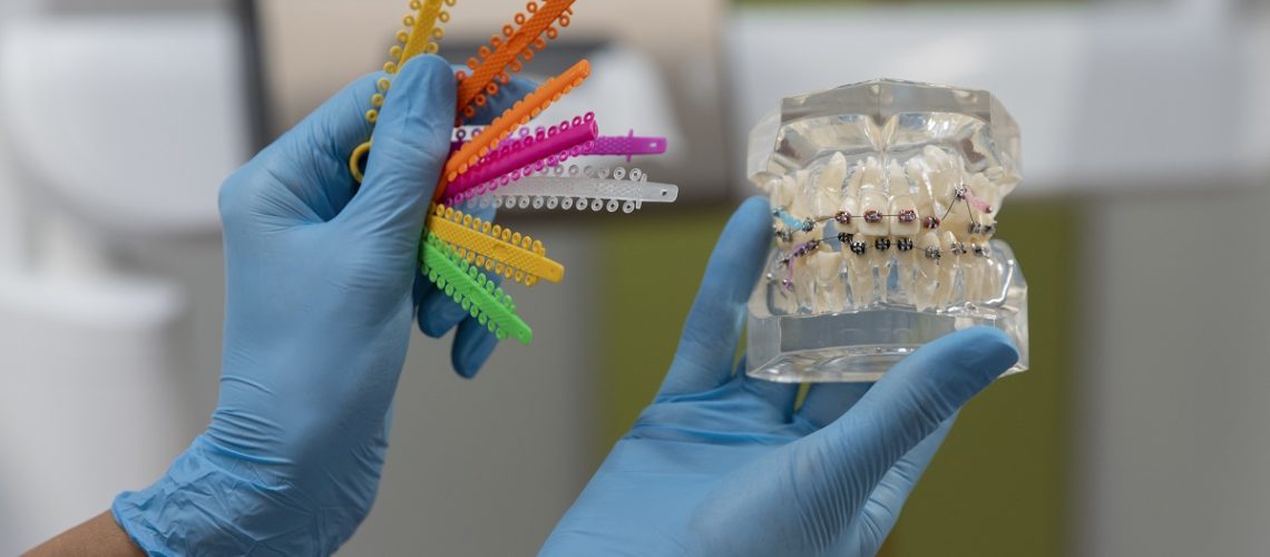el-bisfenol-en-odontología-biológica-clinica-dental-gran-via-alicante-dentista-alicante (3)