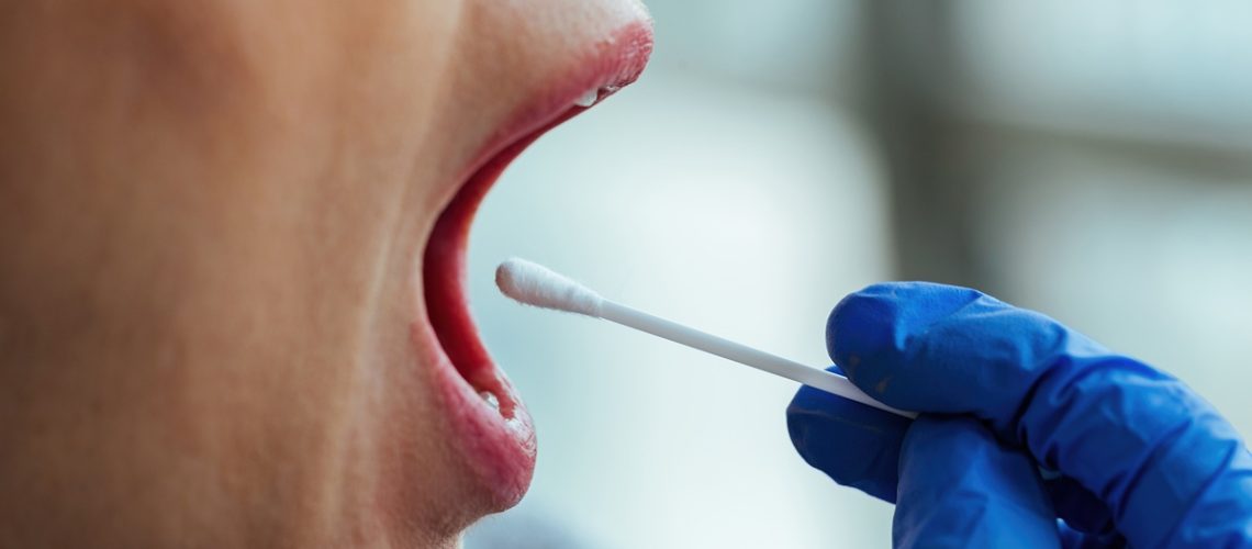 sítomas-de-la-candidiasis-en-la-boca-Clínica-dental-Gran-Vía-Alicante-dentista-alicante-clinica-dental-alicante (1)